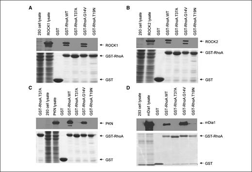 Figure 2. Mutant RhoA-T37A is incapable of interacting with well-known Rho effectors. Various plasmids, Prks-ROCK1, Prks-ROCK2, Prc-PKN-AL, and pFL-mDia1, were transfected into 293T cells, and cell lysates were incubated with GTP-γ-S–loaded GST, or various GST fusion proteins, and loaded into SDS-PAGE gel. After separation of proteins, the gels were cut into two parts: the upper part was transferred to PVDF membrane and probed with anti-myc and anti-flag antibodies to detect myc-tagged ROCK1 or ROCK2 and flag-tagged PKN or mDia1 and the lower part that contains GST or GST fusion proteins was stained with Coomassie Blue R-250.
