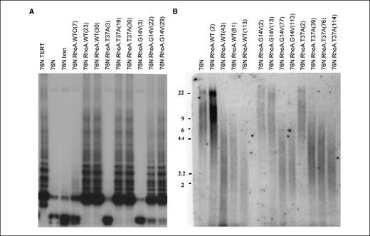 Figure 3. Telomerase activity is induced in immortal cells and the telomere length is maintained. A, telomerase activity at indicated passages (shown in parenthesis) was measured with extracts of 76N.TERT (positive control), 76N, 76N transduced with pLXSN vector (negative control), RhoA-WT, or various Rho mutants. B, the telomere length was determined by digesting genomic DNA from cells. The digested DNA was hybridized with a telomeric probe as described in Materials and Methods.