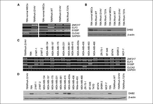 Figure 6. Microarray comparison of Rho-immortalized cells with parental cells identified several differentially expressed genes. Confirmation by RT-PCR and Western blotting. A, RT-PCR analyses showed that ZNF-217, ELF3, and S100P mRNAs were overexpressed in RhoA-immortalized cells, whereas CLCA2 mRNA expression was lower in RhoA-immortalized cells compared with parental 76N or 70N cells. Glyceraldehyde-3-phosphate dehydrogenase (GAPDH) was used as a PCR control. B, Western blotting of indicated cell lysates showed that DAB2 protein is decreased in RhoA-immortalized cells compared with parental 76N or 70N cells. β-Actin was used as a loading control. C, RT-PCR analysis of ZNF217, ELF3, S100P, and CLCA2 mRNA expression in breast cancer cell lines. Similar to RhoA-immortalized cells, several breast cancer cell lines showed increased mRNA expression for ZNF217, ELF3, and S100P and decreased mRNA expression for CLCA2 compared with normal 76N cells. D, Western blotting of cell lysates from breast cancer cell lines showed that, similar to Rho-immortalized cells, several breast cancer cell lines express lower levels of DAB2 protein compared with normal 76N and 70N cells.