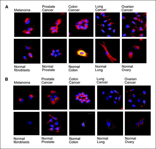 Figure 2. Entry of azu 60 to 77 (p18b) and azu 66 to 77 (p12) into cancer and normal cells. Cells were incubated with Alexa Fluor 568–labeled p18b (A) or p12 (B) at 37°C for 2 h and images recorded by confocal microscopy. Red, Alexa Fluor–labeled peptide; blue, API (nucleus). Green or yellow, Autofluorescence in normal cell lines (green+red).