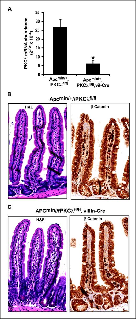 Figure 4. Tissue-specific knockout of PKCλ does not overtly affect intestinal crypt architecture or polarity. A, tissue-specific, Cre-recombinase–mediated knockout of PKCλ in the intestinal epithelium. QPCR analysis of RNA isolated from the intestinal epithelium of ApcMin/+/PKCλfl/fl and ApcMin/+/PKCλfl/fl/villin-Cre mice shows loss of PKCλ expression as a result of Cre-mediated recombination. *, P = 0.002; n = 3. B and C, ApcMin/+/PKCλfl/fl (B) and ApcMin/+/PKCλfl/fl/villin-Cre (C) mice stained by H&E (left) reveals no overt changes in crypt-villus structure. β-catenin staining (right) is unchanged in ApcMin/+/PKCλfl/fl/villin-Cre mice when compared with ApcMin/+/PKCλfl/fl mice, indicating that cellular polarity is not disrupted by PKCλ knockout.