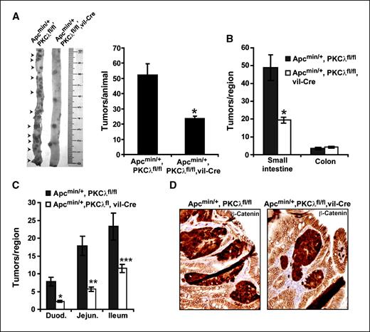 Figure 5. Tissue-specific knockout of PKCλ inhibits tumorigenesis in ApcMin/+ mice. A, genetic deletion of PKCλ inhibits intestinal tumorigenesis. ApcMin/+/PKCλfl/fl mice develop numerous tumors throughout the intestinal epithelium, whereas ApcMin/+/PKCλfl/fl/villin-Cre mice develop significantly fewer tumors throughout the intestinal tract. *, P = 0.000002. B, genetic deletion of PKCλ inhibits tumor formation in the small intestine but not the colon. *, statistically significant difference P = 0.000004. C, deletion of PKCλ nhibits tumorigenesis throughout the small intestine. *, P = 0.000001; **, P = 0.000001; ***, P = 0.0007. A to C, n = 19 for ApcMin/+/PKCλfl/fl mice; n = 33 for ApcMin/+/PKCλfl/fl/villin-Cre mice. D, β-catenin staining of intestinal tumors from ApcMin/+/PKCλfl/fl and ApcMin/+/PKCλfl/fl/villin-Cre mice, demonstrating elevated expression and nuclear localization in tumor from both genotypes.