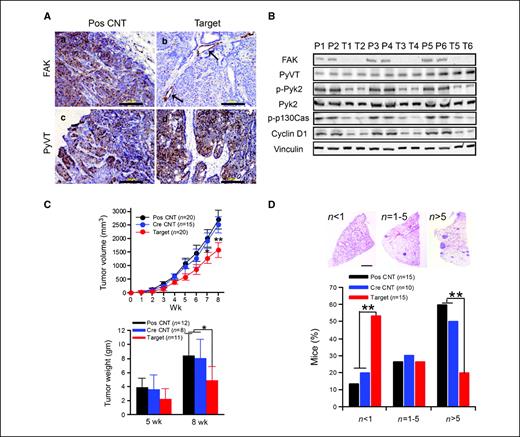 Figure 2. Analyses of protein expression, tumor growth, and metastasis in Target mice. A, sections from the primary tumors of the PosCNT (a, c) and Target (b, d) mice were analyzed by immunohistochemistry using antibodies against FAK (a, b) or PyVT (c, d). The arrows mark blood vessels in b. Scale bars, 200 μm. B, lysates of six tumors in three different PosCNT (P1–P6) and Target (T1–T6) mice were prepared and analyzed by immunoblotting using antibodies against various proteins, as indicated. C, mean cumulative mammary tumor volume (±SD; top) and weight (±SD; bottom) for each genotype at indicated times after primary tumor appearance were plotted and analyzed. *, P < 0.05; **, P < 0.01, when Target mice is compared with either PosCNT or CreCNT mice. D, lung sections (four to six sections per mouse) were prepared at 8 wk after the primary mammary tumor onset and stained with H&E, and the micrometastatic nodules were quantitated under a microscope. Top, representative images with <1, 1-5, or >5 metastases per lung section; bottom, percentages of mice of the indicated genotype with <1, 1-5, or >5 metastases per lung section. Scale bar, 2 mm. **, P < 0.01, when Target mice is compared with either PosCNT or CreCNT mice.