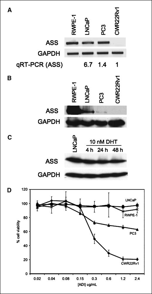 Figure 1. Prostate cancer cell lines profiled for ASS expression and ADI-PEG20 sensitivity. RWPE-1, LNCaP, PC3, and CWR22Rv1 were examined for ASS mRNA by RT-PCR (A) and ASS protein by immunoblotting (B). C, immunoblot for 10 nmol/L DHT time course of LNCaP against α-ASS. D, cell lines were treated by ADI-PEG20 at 0.02, 0.04, 0.08, 0.15, 0.3, 0.6, 1.2, and 2.4 μg/mL for 3 (PC3) or 6 d before MTT assay. Points, mean; bars, SD.