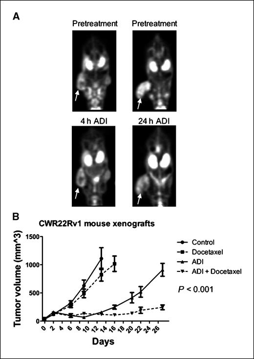 Figure 3. ADI-PEG20 is an effective agent in vivo. A, mice with CWR22Rv1 xenografts were imaged by PET using 18F-FDG before and after treatment with 5 IU ADI-PEG20 for 4 or 24 h. B, mice with CWR22Rv1 xenografts were treated with PBS vehicle, 10 mg/kg docetaxel, 5 IU ADI-PEG20, or 5 IU ADI-PEG20+10 mg/kg docetaxel weekly. Tumor volumes are reported as mean ± SE.
