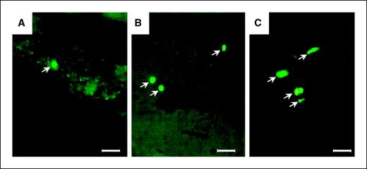 Figure 1. Brain metastasis of LOX cells visualized by GFP. A to C, micrometastases (arrows) are visualized in the brain of nude mice by GFP expression. Imaging was done with a Nikon microscope equipped with a Xenon lamp power supply with a GFP filter set (Chroma Technology). Bar, 80 μm.