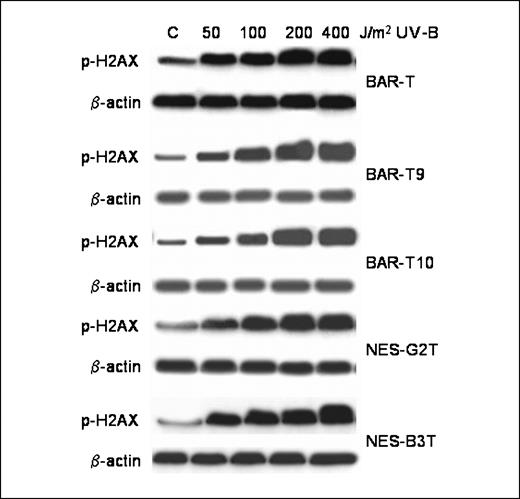 Figure 1. Representative Western blots demonstrating a dose-dependent increase in phospho-H2AX expression after UV-B irradiation with 50 to 400 J/m2 in BAR-T and NES cells.