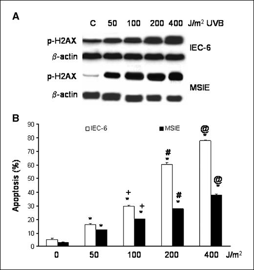 Figure 3. A, representative Western blots demonstrating a dose-dependent increase in phospho-H2AX expression after UV-B irradiation with 50 to 400 J/m2 in IEC-6 and MSIE intestinal cells. B, results of UV-B irradiation on apoptosis in IEC-6 and MSIE cells as determined by Annexin V staining. Columns, mean of at least three individual experiments; bars, SE. *, P < 0.001 compared with nonirradiated controls; +, P < 0.001 compared with 50 J/m2; #, P < 0.001 compared with 100 J/m2; @, P < 0.001 compared with 200 J/m2.