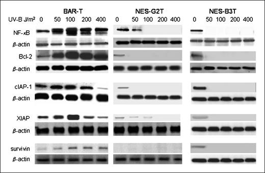 Figure 4. Representative Western blots demonstrating expression of NF-κB, Bcl-2, cIAP-1, XIAP, and survivin after irradiation with 50 to 400 J/m2 UV-B in BAR-T, NES-G2T, and NES-B3T cell lines. Note the expression of these survival proteins increases in BAR-T cells, but decreases in the NES cell lines in response to UV-B. Note that low-dose UV-B irradiation (50 J/m2) virtually abolishes the expression of NF-κB and XIAP in the NES-B3T cells but not in the NES-G2T cells.
