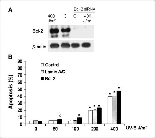 Figure 6. A, Western blots for Bcl-2 expression after siRNA infection. Note that Bcl-2 protein expression is inhibited after infection with Bcl-2 siRNA at baseline and after treatment with 400 J/m2. B, results of UV-B irradiation and Bcl-2 siRNA on apoptosis as determined by Annexin V staining; siRNA against lamin A/C served as a control. Note that inhibition of Bcl-2 causes a small but statistically significant increase in apoptosis in response to low-dose UV-B irradiation. Columns, mean of at least three individual experiments; bars, SE. &, P < 0.01 compared with nonirradiated corresponding control; *, P < 0.001 compared with nonirradiated corresponding controls.