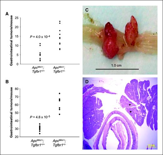Figure 2. Tumorigenesis of ApcMin/+;Tgfbr1+/+ and ApcMin/+;Tgfbr1+/− mice. A and B, number of gastrointestinal tumors per mouse at 12 wk of age for ApcMin/+;Tgfbr1+/+ mice (n = 9) and ApcMin/+;Tgfbr1+/− littermates (n = 10) in mixed 129Svlm/C57BL/6 background (A) and in ApcMin/+;Tgfbr1+/+ mice (n = 12) and ApcMin/+;Tgfbr1+/− littermates (n = 7) in C57BL/6 background (B). Points, no. of tumors in each individual mouse. C, large polyps arising from ApcMin/+;Tgfbr1+/− mouse colonic mucosa at 12 wk. Bar, 1 cm. D, histologic analysis of the large polypoid colonic tumor from the ApcMin/+;Tgfbr1+/− mouse shown in C. Black arrowheads, presence of carcinoma. Bar, 1 mm; 100 μm.
