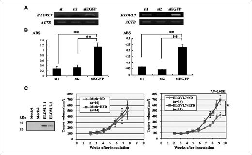 Figure 2. ELOVL7 was involved in prostate cancer cell growth. A, knockdown effect on ELOVL7 in 22Rv1 cells (left) and LNCaP cells (right). Semiquantitative RT-PCR was performed using cells transfected with each of shRNA-expressing vectors to ELOVL7 (si1 and si2) as well as a negative control vector (siEGFP). ACTB was used as a loading control. B, MTT assay of 22Rv1 cells (left) and LNCaP cells (right) transfected with indicated shRNA-expressing vectors to ELOVL7 (si1 and si2) and a negative control vector (siEGFP). Points, mean; bars, SD. ABS on Y-axis, absorbance at 490 nm, and at 630 nm as a reference. C, high-fat diet promoted ELOVL7-expressing prostate cancer cells in vivo. Western blot analysis using HA-tag antibody (left) showed that two clones of LNCaP-ELOVL7 (ELOVL7-1 and ELOVL7-2) constitutively expressed exogenous ELOVL7. LNCaP-mock cells (middle) were inoculated into male nude mice that were bred with normal diet (ND; n = 10) or high-fat diet (HFD; n = 14). LNCaP-ELOVL7-1 cells (right) were inoculated into male nude mice that were bred with normal diet (n = 14) or high-fat diet (n = 11). High-fat diet breeding significantly promoted the growth of LNCaP-ELOVL7-1 cells in vivo comparing to normal diet breeding (P = 0.0081 by Student's t test).