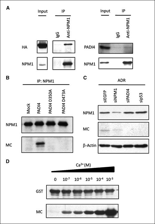 Figure 4. NPM1 is a substrate of PADI4. A, interaction of NPM1 and PADI4. Cell extracts from HEK293T cells that were transfected with plasmid expressing HA-PADI4 were immunoprecipitated using anti-NPM1 antibody or mouse IgG, followed by immunoblotting with anti-HA or anti-NPM1 antibody (left). Cell extracts from U373MG cells that were infected with Ad-p53 were immunoprecipitated using anti-NPM1 antibody or mouse IgG, followed by immunoblotting with anti-PADI4 or anti-NPM1 antibody (right). B, HEK293T cells were transfected with each plasmid indicated. Cell extracts were immunoprecipitated using anti-NPM1 antibody, followed by immunoblotting with anti-NPM1 or anti-MC antibody. C, U-2 OS cells were transfected with each siRNA 6 h prior to treatment with ADR. siEGFP was used as a control. At 36 h after treatment, whole cell extracts were subjected to immunoblotting with anti-NPM1 or anti-MC antibody. D, in vitro citrullination analyses of NPM1. Recombinant NPM1 was incubated with GST-PADI4 in the presence of indicated concentrations of CaCl2 at 37°C for 1 h, followed by immunoblotting with anti-GST or anti-MC antibody.