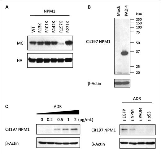 Figure 5. In vivo citrullination of NPM1. A, immunopurified wild-type or mutant NPM1 proteins were incubated with GST-PADI4 in the presence of 1 mmol/L of CaCl2 at 30°C for 1 h, followed by immunoblotting with anti-MC antibody. B, HEK293T cells were transfected with each plasmid indicated and subjected to immunoblotting with anti-citrullinated NPM1 antibody (Cit197 NPM1). C, U-2 OS cells were treated with ADR for 2 h. Each siRNA was transfected at 6 h prior to treatment with 2 μg/mL of ADR (right). siEGFP was used as a control. At 36 h after treatment, whole cell extracts were subjected to immunoblotting with anti-citrullinated NPM1 antibody (Cit197 NPM1).