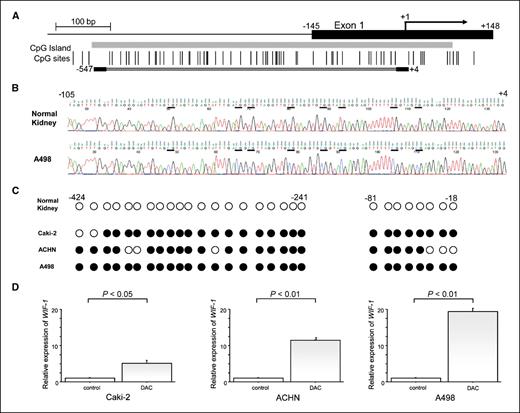 Figure 2. Methylation of the human WIF-1 gene promoter. A, schematic representation of the promoter region of the human WIF-1 gene and primer location. Vertical lines, location of CpG dinucleotides; gray box, CpG island; black box, first exon; arrows, approximate position of the transcription start site; doubled horizontal line, region examined by bisulfite DNA sequencing. B, representative results of the bisulfite sequencing for the normal kidney and the A498 cells (from −105 to +4). The horizontal bars and the ATG surrounded with black boxes indicate CpG sites and the start codon, respectively. C, methylation mapping of 28 CpG sites of the WIF-1 promoter region obtained from bisulfite sequencing in normal kidney and RCC cell lines (from −424 to −241 and from −105 to +4). White and black circles, unmethylated and methylated CpG sites, respectively. D, upregulation of WIF-1 mRNA expression following treatment with DAC in RCC cell lines. Levels of WIF-1 mRNA expression were quantified by real-time RT-PCR.