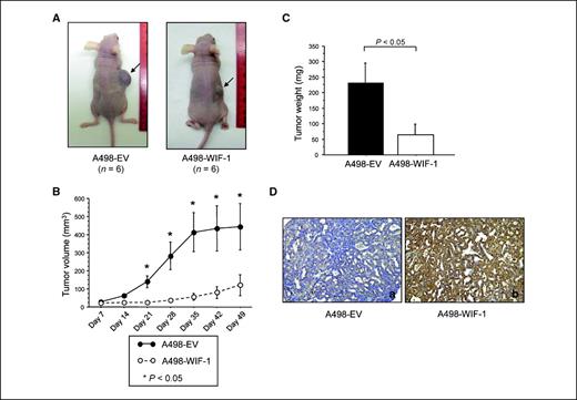 Figure 5. In vivo tumor growth of WIF-1–transfected A498 cells. A, macroscopic appearance of the tumors on day 50 after s.c. inoculation of A498-EV (left) and A498-WIF-1 (right) cells. B, tumor growth curves in nude mice. Black or white circles, mean ± SD of tumor volume (mm3) for EV-transfected or WIF-1–xenografted mice, respectively. C, mean ± SD of tumor weight on day 50. D, representative photographs (×100) of WIF-1 staining of each group (a, EV-inoculated mouse; b, WIF-1–inoculated mouse).