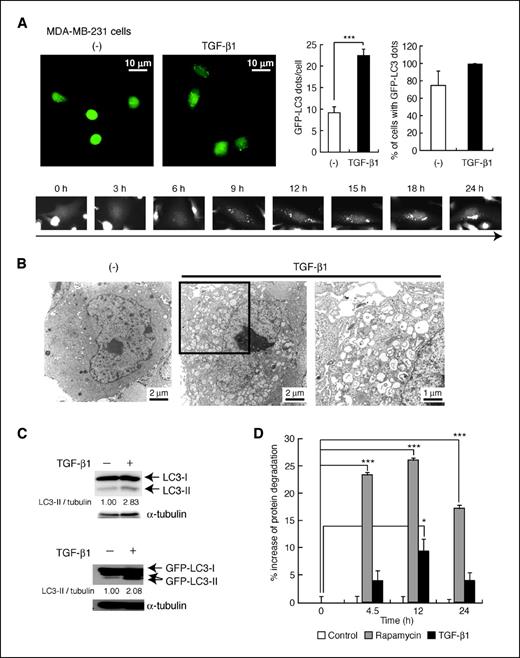 Figure 6. Autophagy is induced by TGF-β in MDA-MB-231 mammary carcinoma cells. A, MDA-MB-231 cells expressing GFP-LC3 were treated with TGF-β1 (1 ng/mL) for 24 h. GFP-LC3 dot formation was observed (top left) and quantified (top right) as in Fig. 1A. ***, P < 0.001. Serial change of GFP-LC3 localization was examined by video microscope (bottom). B, transmission electron microscopy. Cells were treated with TGF-β1 (1 ng/mL) for 24 h. Right, enlarged image of the box in the middle. C, conversion of endogenous LC3 (top) and GFP-LC3 (bottom) in MDA-MB-231 cells by TGF-β1 treatment (1 ng/mL, 9 h). D, long-lived protein degradation assay done as in Fig. 2D. *, P < 0.05; ***, P < 0.001.