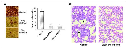 Figure 6. Slug is essential for in vitro invasion and lung metastasis. A, control or slug-knockdown MDA-MB-231 cells were added into invasion chambers and allowed to invade for 24 h. The cells on the undersurface of chambers were stained and visualized under a microscope. Columns, mean; bars, SE. *, P < 0.001, versus control. B, the lungs from mice receiving either control or slug-knockdown MDA-MB-231 cells for 8 wk were fixed and sectioned. The sections were subjected to H&E staining and visualized under a microscope. Arrows, metastatic lesions. Magnification, ×40.