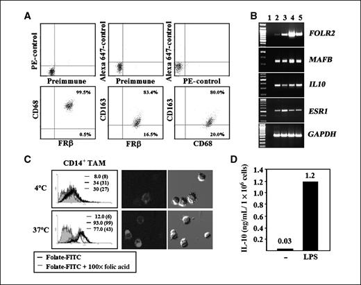 Folate Receptor β Is Expressed by Tumor-Associated Macrophages and ...