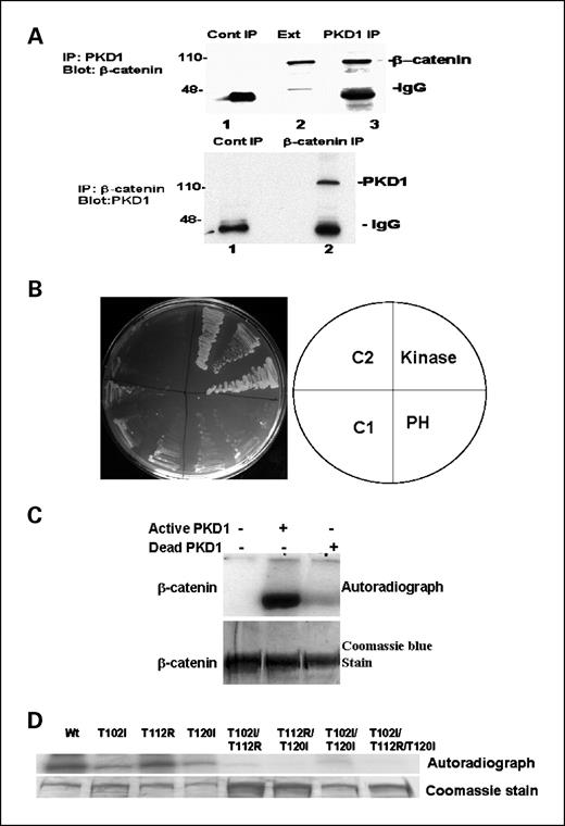 Figure 2. Direct interaction and phosphorylation of β-catenin by PKD1. A, reciprocal coimmunoprecipitation of PKD1 and β-catenin from LNCaP cell. Top, coimmunoprecipitation with PKD1 antibody and blotting with β-catenin antibody. Lane 1, immunoprecipitation with control antibody; lane 2, whole cell lysates only; lane 3, immunoprecipitation with PKD1 antibody. Bottom, coimmunoprecipitation with β-catenin antibody and blotting with PKD1 antibody. Lane 1, immunoprecipitation with control antibody; lane 2, immunoprecipitation with β-catenin antibody. B, yeast two-hybrid test. Three individual colonies were used for testing. Only PKD1 catalytic domain interacts with β-catenin. C, in vitro phosphorylation. Purified full-length glutathione S-transferase (GST)–tagged β-catenin protein from E. coli was incubated with either active or kinase-dead PKD1 in the presence of [γ-32P]ATP. β-Catenin was phosphorylated by active PKD1. D, mapping of PKD1 phosphorylation sites on β-catenin in vitro. Wild-type and mutated GST-tagged full-length β-catenins were expressed in and purified from E. coli. The purified proteins were incubated with purified active PKD1 in the presence of [32P]ATP. After incubation, the proteins were separated by SDS-PAGE, stained with Coomassie blue, and exposed onto films. Refer to Materials and Methods for the mutant nomenclature.