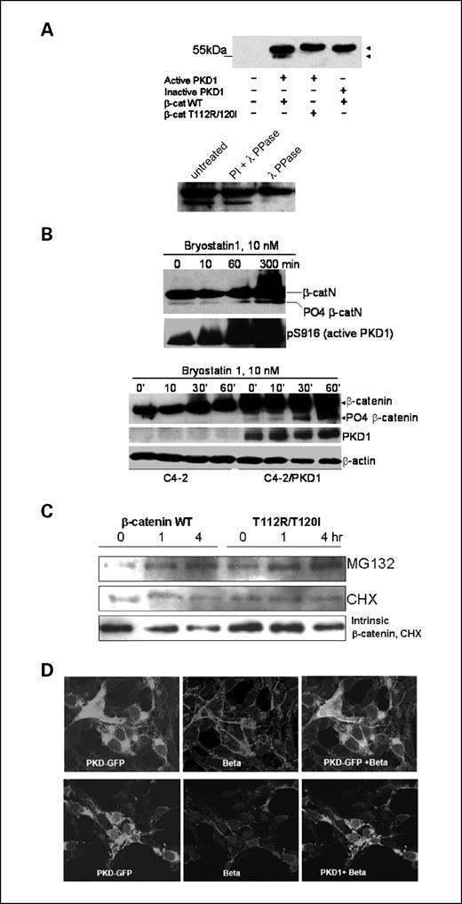 Figure 3. PKD1 phosphorylates β-catenin in vivo. A, top, in vivo phosphorylation of truncated β-catenin. A COOH-terminal truncated construct that includes the first 150 amino acid residues of β-catenin (β-catN) was cotransfected with PKD1 or kinase-dead PKD1 (inactive) into NIH 3T3 cells. Cell lysates were collected 2 d after transfection and immunoblotted with anti-GFP antibody. The wild-type β-catenin has an extra fast-mobile band when incubated with active PKD1, but the band does not appear in the presence of inactive PKD1. When Thr112 and Thr120 were mutated, the fast-mobile band disappeared even in the presence of active PKD1, indicating that these two threonine sites are necessary for PKD1 phosphorylation. The T112R/T120I moves slower than the wild-type because it carries an extra positive charge on the T112R mutation. Bottom, phosphatase treatment. Cells transiently transfected with wild-type β-catN and PKD1 were treated with 10 nmol/L bryostatin 1 for 1 h. The cells were lysed in TBST buffer. The cell lysates were treated with either λ phosphatase or λ phosphatase plus phosphatase inhibitor cocktail (PI; from AG Scientific). After λ phosphatase treatment, the low molecular weight band disappeared. B, activation of PKD1 increases phosphorylation of β-catenin. Top, cells transiently transfected with wild-type β-catN and PKD1 were treated with 10 nmol/L bryostatin 1. The duration of treatment was indicated. The phosphorylated band increased over time. Bottom, endogenous β-catenin phosphorylation increases during PKD1 activation. C4-2 has very low of PKD1 activity (31). When stimulated by bryostatin 1, the endogenous β-catenin in C4-2 cells remained mainly unchanged. In contrast, endogenous β-catenin in C4-2 cells that stably express PKD1 became phosphorylated as indicated by the increase of a low molecular weight band. C, the nonphosphorylated mutant has similar protein stability as wild-type β-catenin. Full-length wild-type and T112R/T120I mutant were transfected into NIH 3T3 cells for 2 d. The cells were treated with either 2 μmol/L of MG132, a proteosome inhibitor, or 20 μmol/L of cycloheximide, a protein synthesis inhibitor, for the times indicated before collection. Immunoblotting was done with anti–β-catenin. The endogenous β-catenin was used as loading control. There was no detectable difference between wild-type and T112R/T120I mutant in protein stability. D, nonphosphorylated β-catenin has altered subcellular location. HA-tagged wild-type and T112R/T120I mutant were individually transfected into C4-2/PKD1 cells. Cells were stained with anti–HA tag antibody. The pattern of mutant β-catenin was different from that of wild-type, with more in nuclei.