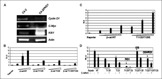 Figure 4. PKD1 modulates β-catenin transcription activity. A, expression of β-catenin target genes cyclin D1, c-Myc, and KAI1in the presence of PKD1. Total RNA from parental C4-2 cells and C4-2/PKD1 cells was amplified by semiquantitative reverse transcription-PCR. Expression of cyclin D1 and c-Myc is higher in C4-2 cells, whereas KAI1 is higher in C4-2/PKD1 cells. B to D, PKD1 phosphorylation increases β-catenin transcription activity (Topflash assay). B, nonphosphorylated β-catenin mutants have decreased transcription activity. Fifty nanograms of Topflash plasmid, 2.5 ng of Renilla luciferase, and 25, 50, and 100 ng of wild-type β-catenin were transfected NIH 3T3 cells. Luciferase assay was carried out 2 d later. C, β-catenin mutant that mimics constitutive phosphorylation has increased transcription activity. D, comparison of PKD1 and CKII phosphorylation on β-catenin transcription activity. Topflash assays were done with wild-type β-catenin and indicated mutants alone or in the presence of full-length E-cadherin. CKII phosphorylation on Thr102/Thr112 does not affect β-catenin transcription activity. E-cadherin can bind to all β-catenin isoforms as indicated by its inhibitory effect on Topflash assay. Data were normalized and all experiments were done in triplicate. Bars, SD.