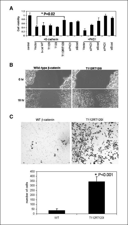 Figure 5. Phosphorylation regulates β-catenin–mediated cell proliferation and motility. A, nonphosphorylated β-catenin has more potential to rescue LNCaP cells that overexpress E-cadherin. LNCaP cells were transfected with 100 ng of full-length E-cadherin or PKD1 expression vector. Fifty nanograms of β-catenin constructs (wild-type or mutants as indicated) or 25 ng of siPKD1 or siE-cadherin were individually cotransfected with E-cadherin or PKD1. Cell viability was measured 48 h after transfection by MTS method (Promega). The experimental conditions were optimized so that the wild-type β-catenin construct had marginal rescue power. Cells with T112R/T120I grew faster than those with wild-type β-catenin in the presence of E-cadherin. Knockdown PKD1 by siRNA could restore cell growth inhibited by E-cadherin overexpression and vice versa. Bars, SD based on triplicate samples. P value was determined by using one-way ANOVA. B, nonphosphorylated β-catenin enhances cell migration. Transiently transfected 3T3 cells expressing wild-type or T112R/T120I were subjected to wound healing assay 2 d after transfection. The photograph was taken 18 h after wound was created. C, Matrigel assay of cell invasion. Full-length wild-type and T112R/T120I mutant β-catenin expression vectors were transfected into 3T3 cells for 2 d before adding to transwells containing Matrigel. The cells were grown on Matrigel for 2 d. Attached cells were stained using Diff Quick kit (top). Columns, average number of attached cells per filter based on triplicate samples; bars, SD (bottom).