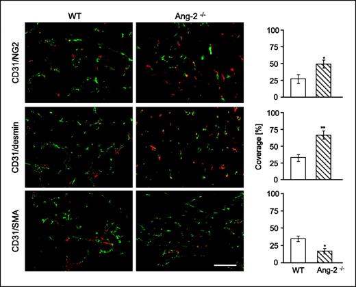 Figure 3. Effect of Ang-2 deficiency on mural cell recruitment and maturation during later stages of LLC growth. Tumors were grown s.c. in WT and Ang-2–deficient mice and harvested when the first tumors had grown to 2 cm3. Tumor sections were double-stained for the endothelial cell marker CD31 (green) and for the mural cell markers NG2, desmin, and α-SMA (red). Vessel coverage was calculated as the percentage of NG2-, desmin-, and α-SMA–positive vessels compared with the number of CD31-positive vessels. As in day 12 mice, late-stage LLC tumors grown in Ang-2–deficient mice had higher coverage by NG2- and desmin-positive and less coverage by α-SMA–positive mural cells. *, P < 0.05; **, P < 0.01. Bar, 100 μm.