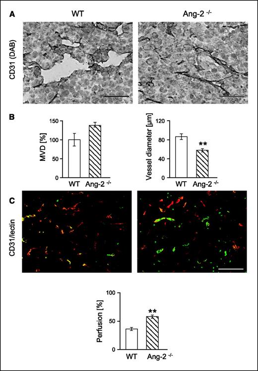 Figure 4. Effect of host-derived Ang-2 deficiency on MVD (A and B), diameter of intratumoral microvessels (A and B), and perfusion (C) in LLC tumors. Tumors were grown in WT and Ang-2–deficient mice and harvested when the first tumors had grown to 2 cm3. MVDs and vessel diameters were quantitated in CD31-stained tissue sections. Perfusion was assessed on the basis of FITC-lectin perfusion labeling. Ang-2 deficiency had a nonsignificant effect on intratumoral MVD. Yet, the average diameters of intratumoral microvessels were significantly reduced in tumors grown in Ang-2–deficient mice. Correspondingly, intratumoral microvessels in Ang-2–deficient mice were better perfused. **, P < 0.01. Bar, 200 μm.