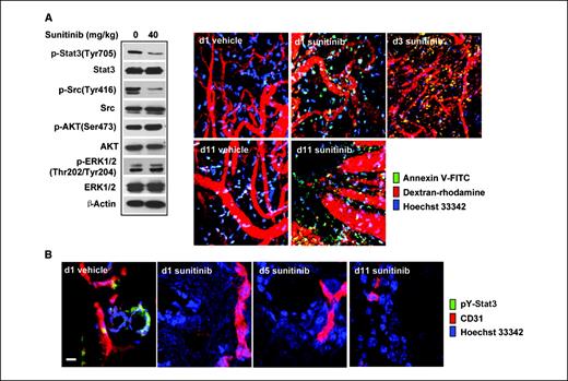 Figure 5. Sunitinib inhibits tumor Stat3 activity in vivo, leading to tumor cell apoptosis, which occurs before tumor vessel collapse. A, BALB/c mice were challenged with Renca tumor cells and then treated with sunitinib 7 d later. On indicated days after first sunitinib treatment, mice were given retroorbital injections of FITC-labeled Annexin V (green, to detect apoptotic cells), dextran-rhodamine (red, to stain vessels), and Hoechst 33342 (blue, to stain nuclei). IVMPM analysis was performed, 15 min after injection, on tumors grown in mice treated with vehicle or sunitinib. Western blot analysis of Renca tumor tissues harvested 1 d after sunitinib treatment shows its effects on p-Stat3 and other indicated molecules. B, frozen tumor sections of vehicle- and sunitinib-treated tumors (same as in A) were stained for phosphotyrosine-Stat3 (pY-Stat3; green), CD31/PECAM-1 (red), and Hoechst 33342 (blue) and analyzed by confocal laser scanning microscopy. Scale bar, 10 μm.