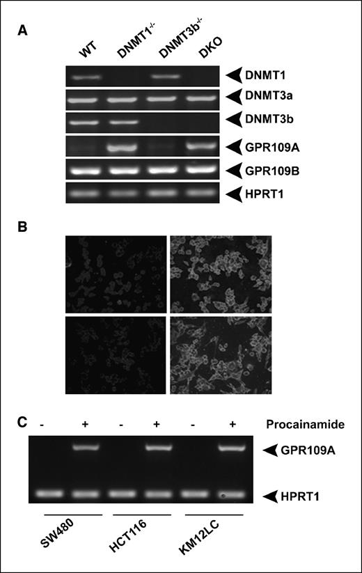 Figure 3. Involvement of DNMT1 in the silencing of GPR109A. A, analysis of expression of GPR109A and GPR109B by RT-PCR in the human colon cancer cell line HCT116, which expresses all three isoforms of DNMT (WT), and in isogenic HCT116 cell lines with targeted deletion of DNMT1 (DNMT1−/−), DNMT3b (DNMT3b−/−), or both (DKO). B, immunocytochemistry for GPR109A protein in WT, DNMT1−/−, DNMT3b−/−, and DKO cells. C, effect of procainamide, a specific inhibitor of DNMT1, on GPR109A expression in colon cancer cell lines.