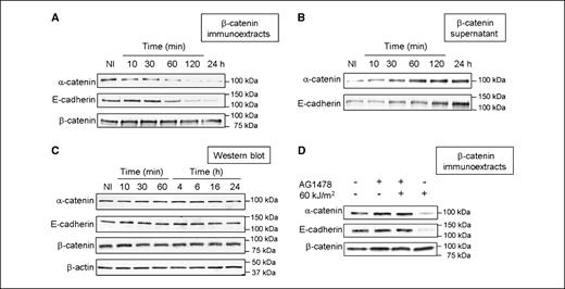 Figure 2. Effect of UVA on the cadherin-catenin complex. A and B, HaCaT cells were irradiated at 60 kJ/m2 and incubated for different times before cell lysis. α-Catenin, E-cadherin, and β-catenin expressions were evaluated by Western blot analysis done with immunoextracts (A) or supernatants after removal of β-catenin immunocomplexes (B). C, HaCaT cells were irradiated at 60 kJ/m2 and incubated for different times before lysis, and α-catenin, E-cadherin, and β-catenin expressions were evaluated by Western blotting. D, HaCaT cells were pretreated or not for 1 h with AG1478 (10 μmol/L), irradiated or not at 60 kJ/m2, and incubated for 2 h before β-catenin immunoprecipitation. Representative of three independent experiments.