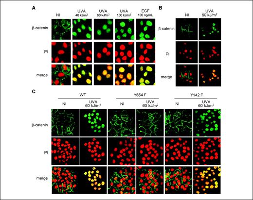 Figure 3. Effect of UVA on β-catenin intracellular distribution and role of Y654 β-catenin phosphorylation. A and B, β-catenin localization was evaluated by confocal microscopy 2 h after irradiation or EGF treatment on HaCaT (A) or NHEK (B) cells. C, β-catenin localization was evaluated by confocal microscopy at 2 h on HaCaT transfected with plasmids encoding WT β-catenin, Y654F mutant, or another Y-to-F mutant, Y142F β-catenin (as used as control), irradiated or not (NI) with UVA (60 kJ/m2). Representative of three independent experiments.