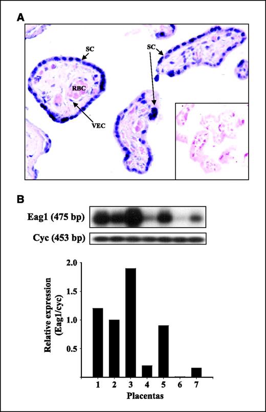 Figure 1. Eag1 channels in human placenta. A, Eag1 protein was immunolocalized (dark blue-violet staining) in the cytoplasm, nucleus of the syncytiotrophoblast layer (SC), and nucleus of vascular endothelial cells (VEC). Magnification, 200×. Insert, negative control in the absence of Eag1 antibody. Image is representative of seven placentas. In some other sections, Eag1 was also expressed in the plasma membrane (data not shown). B, Southern blot analysis (top) from RT-PCR experiments of seven different normal-term placentas. All of them displayed Eag1 expression. Columns, Eag1 mRNA relative expression after normalization with the constitutive gene cyclophilin (cyc).