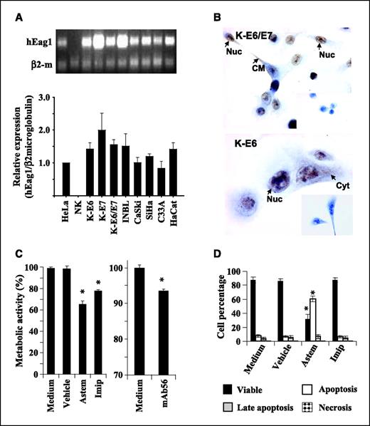 Figure 4. Eag1 in cervical cancer cells and effect of Eag1 inhibitors in cell proliferation and apoptosis of keratinocytes expressing HPV oncogenes. A, duplex PCR experiments and densitometric analysis for Eag1 and β2-microglobulin showed no Eag1 expression in normal keratinocytes (NK); in contrast, keratinocytes expressing HPV oncogenes (K-E6, K-E7, or both, K-E6/E7) expressed Eag1. Eag1 was also found in transformed keratinocytes without HPV (HaCat and C33A) and in cervical cancer cell lines with either HPV-16 (CaSki and SiHa) or HPV-18 (HeLa and INBL). Columns, mean of Eag1 mRNA relative expression after normalization with β2-microglobulin (β2-m); bars, SD. Eag1 expression in HeLa cells was given the value of 1. B, Eag1 protein (brown staining) in K-E6/E7 and K-E6 cells can be observed in the plasma membrane (CM), nuclear membrane (Nuc), or cytoplasm (Cyt). Negative controls in the absence of the Eag1 antibody are shown in the insets. Magnification, 800×. C, nonspecific Eag1 inhibitors astemizole (Ast) and imipramine (Imip; 10 μmol/L, 96 h) decreased cell proliferation of keratinocytes expressing both HPV oncogenes (K-E6/E7), assayed by metabolic activity; the anti-Eag1 monoclonal antibody 56 (mAb56), a very specific inhibitor of Eag1, also decreased metabolic activity. D, astemizole increased apoptosis in these K-E6/E7 cells. Columns, mean; bars, SD. *, P < 0.05 compared with control (medium or vehicle).