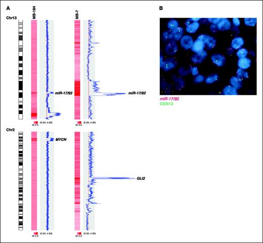 Figure 1. Recurrent amplification of the miR-17/92 locus in primary human medulloblastomas. A, top, focal, high-level amplification of miR-17/92 on chromosome 13q31.3 in two medulloblastomas. These samples also show amplification of MYCN and GLI2 (MB-184 and MB-7, respectively; bottom). B, representative FISH for a medulloblastoma with amplification of miR-17/92 using a BAC clone mapping to the miR-17/92 locus (red) and a chromosome 13 centromere control probe (green).
