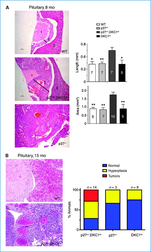 Figure 3. DKC1 and p27 genetically cooperate toward pituitary tumorigenesis. A, micrographs of H&E-stained paraffin sections prepared from pituitary glands of 8-mo-old WT, p27+/−;DKC1m (hyperplasia) and p27−/− (tumor) animals. Numbers on the pictures indicate: (1) pars nervosa, (2) pars intermedia (intermediate lobe), and (3) pars distalis, bars, 10 nm. Columns, mean length and area of the intermediate lobe; bars, SEM. The number of animals analyzed for each genotype is indicated on the columns. Statistical analysis was performed using unpaired two-tailed t tests (**, P < 0.01; *, P < 0.05). B, representative histopathologic analysis of a normal pituitary gland (top) and a pituitary carcinoma (bottom) from 15-mo-old WT and p27+/−;DKC1m mice, respectively. Graph shows the percentages of double p27+/−;DKC1m, p27+/− and DKC1m animals with a normal pituitary (blue), pituitary hyperplasia (yellow), and pituitary cancers (red).