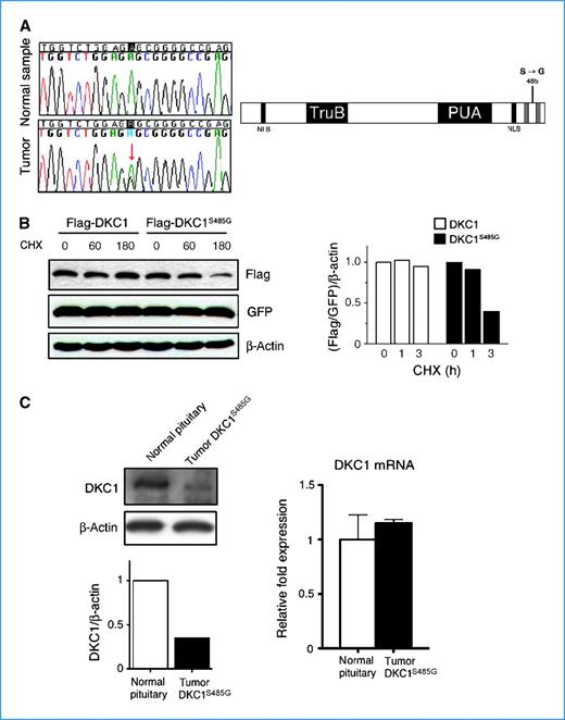 Figure 4. Identification of a novel DKC1 mutation in a human pituitary adenoma. A, chromatographs showing a novel mutation in the DKC1 locus identified in a human pituitary adenoma (left). Scheme of the mutation, an A1493G variation located on one DKC1 allele leads to the amino acid change S485G in the COOH-terminal portion of the protein (right). B, analysis of DKC1S485G protein stability. Densitometric analysis of the DKC1 levels was done at each time point after blockage of protein synthesis as indicated. GFP was cotransfected for transfection efficiency and β-actin was used as loading control. C, DKC1 protein (left) and mRNA (right) levels in a normal pituitary and in the tumor bearing the mutation DKC1S485G. Densitometric analysis of DKC1 over β-actin protein levels in each sample (bottom left).