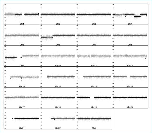 Figure 1. CBS analysis of T38 CAF, showing chromosomal aberrations. Fibroblast DNA was hybridized to a 244K aCGH microarray and analyzed by CBS analysis. Gray clouds are the accumulation of individual probe values, represented as normalized log 2 ratios. The black lines centered at approximately zero are the mean values of the segments generated by the CBS algorithm. Large deletions are observed in chromosomes 4, 6, and 9.