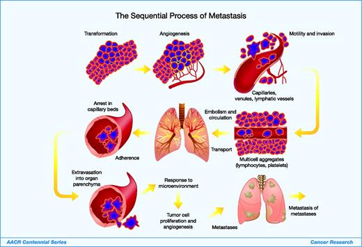 AACR Centennial Series: The Biology of Cancer Metastasis: Historical ...