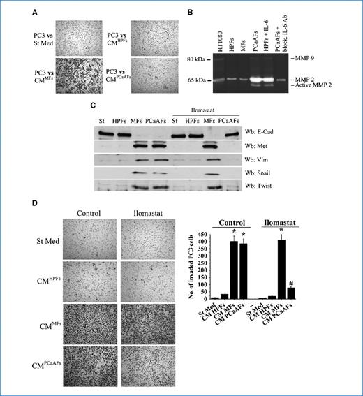 Figure 3. MP production by PCa-AFs leads to PC3 increased invasiveness. A, invasion of PC3 cells, toward CM from HPFs, MFs, or PCa-AFs, was analyzed. B, HPFs were activated for 24 h with 10 ng/mL TGF-β1 (MFs), 50 ng/mL IL-6 (HPFs+IL-6), or CMPC3 (PCa-AFs) with or without IL-6–blocking antibodies, and then starved for 24 h. Gelatin zymography analysis was performed on the corresponding CM. C, PC3 cells were incubated for 24 h with CM from HPFs, MFs, and PCa-AFs in the presence of 50 μmol/L ilomastat, and the expression of E-Cadherin, Met, vimentin, Snail and Twist was analyzed by immunoblotting. D, PC3 cells were treated as in C, and their invasion was evaluated. Photographs and bar graph, representative of six randomly chosen fields. *, P < 0.001 versus St Med. #, P < 0.001 versus control CM PCa-AFs.