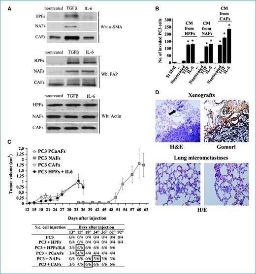 Figure 5. CAFs from PCa strongly enhance the aggressiveness of PC3 cells. A, α-SMA and FAP expression analysis of HPFs, NAFs, or CAFs treated for 24 h with 10 ng/mL TGF-β1 or 50 ng/mL IL-6 was performed by immunoblotting. B, PC3 cells were incubated with CM from HPFs, NAFs, or CAFs activated as described in A, and their invasion was evaluated. Bar graph is shown. *, P < 0.001 versus St Med. C, xenograft growth in SCID bg/bg mice of PC3 cells s.c. injected with activated fibroblasts. Top, primary tumor growth; bottom, tumor incidence. D, paraffin-embedded tissue sections from primary tumor (top; original magnification, ×20) and lung micrometastases (bottom; original magnification, ×40) obtained by PC3/CAFs coinjection in SCID bg/bg-mice were stained with H&E or with Gomori.