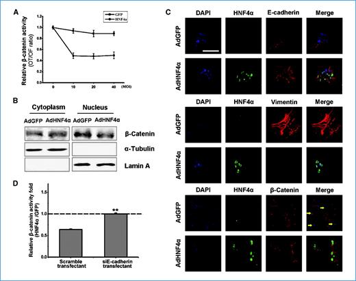 Figure 6. HNF4α suppresses Wnt/β-catenin signaling. A, luciferase reporter activity of β-catenin in HepG2 cells was measured 48 h after adenovirus infection. The β-catenin–mediated transcription activity was assessed by the OT/OF ratio. MOI, multiplicity of infection. B, Western blot analysis of nuclear extraction from AdHNF4α- or AdGFP-infected L02 cells underwent TGF-β1 treatment for 24 h. C, the rat primary hepatocytes were double immunostained for HNF4α (green) together with E-cadherin (red), vimentin (red), or β-catenin, respectively. 4′,6-Diamidino-2-phenylindole (DAPI) was used for the counterstaining of DNA (blue). Magnification, ×400; scale bar, 100 μm. D, siE-cadherin–transfected 293T cells and the control cells were infected by AdGFP and AdHNF4α, respectively. Luciferase reporter activity of β-catenin was analyzed as described above. The result showed the relative β-catenin activation folds of AdHNF4α-infected cells versus AdGFP-infected cells in siE-cadherin transfectant and scramble transfectant, respectively. **, P < 0.01.