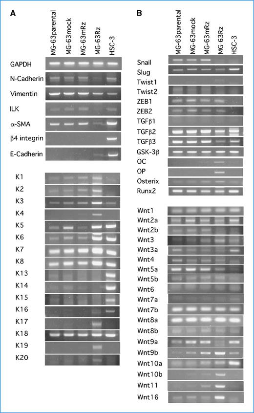 Figure 3. RT-PCR. Silencing of AMF leads MET in osteosarcoma MG-63 cells. A, PCR for mesenchymal and epithelial markers. Mesenchymal markers: N-cadherin, vimentin, ILK, and α-SMA. Epithelial markers: E-cadherin and cytokeratins (K1 to K8 as basic; K13 to K20 as acidic). B, PCR for EMT-related molecules, osteoblast differentiation-related genes, and Wnt genes. Silencing of AMF induced MET in MG-63 cells and terminal differentiation into osteoblasts. B, Wnt2b, Wnt5a, and Wnt9a are suppressed, and Wnt3, Wnt10b, Wnt11, and Wnt16 are enhanced by AMF gene silencing.