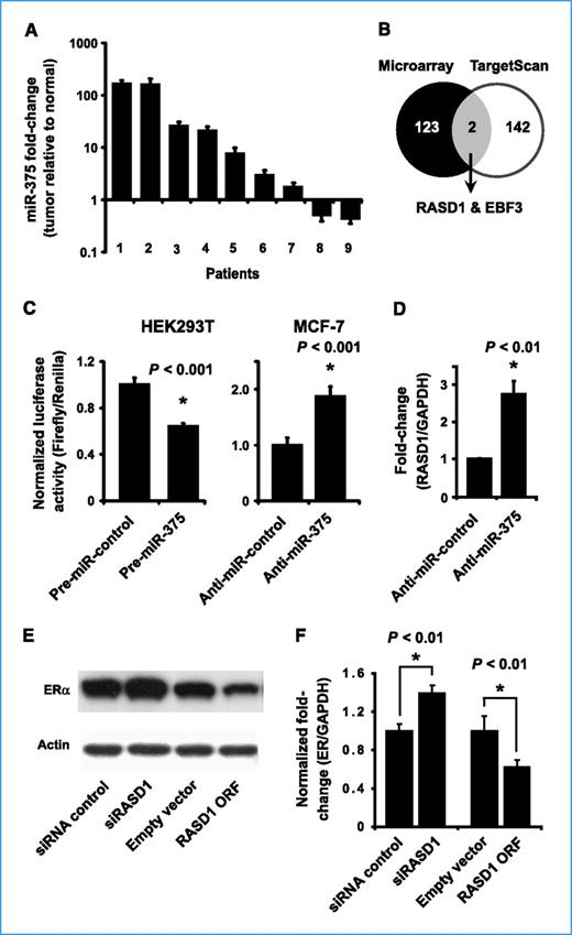 Figure 4. RASD1 is a functional target of miR-375 and negatively regulates ERα. A, miR-375 expression in breast cancer patients measured by qRT-PCR. Values are represented as the ratio of miR-375 expression in tumors versus matched normal tissues. B, comparison between 125 genes commonly downregulated in patients 1, 2, 6, 7 (who showed overexpression of miR-375), and 144 predicted targets of miR-375. C, relative luciferase activity in HEK293T and MCF-7 cells transfected with the RASD1 3′ UTR reporter construct. Luciferase activity was measured in five replicates in three independent experiments. D, RASD1 expression in MCF-7 cells after transfection with anti-miR-375 measured by qRT-PCR. Values are presented as mean of three measurements ± SD. E and F, effect of RASD1 silencing and overexpression on ERα protein (E) and mRNA levels (F). Values are presented as mean of three measurements ± SD.