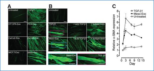 Figure 2. Cancer exosomes trigger α-smooth muscle (α-SAM) actin expression in fibroblasts. A, primary fibroblasts were growth arrested for 72 hours prior to stimulation with exosomes isolated from various cell lines as specified (at a dose of 200 μg/mL). As a positive control, fibroblasts were treated with rhTGF-β1 (5 ng/mL). After a further 72 hours, the fibroblasts were examined by immunohistochemistry for the expression of α-SAM. Scale bar, 100 μm. B, similarly, fibroblasts were stimulated with exosomes (mesothelioma exosomes shown) or rhTGF-β1 in the presence or absence of a TGF-β1–neutralizing antibody (at 10 μg/mL) or an irrelevant isotype-matched antibody (at 10 μg/mL). Also, selected regions exemplify the α-SMA–positive filamentous structures along the longitudinal axis of the fibroblast cell body that are apparent on rhTGF-β1 (red box) or exosome treatment (blue box). Scale bar, 100 μm. C, comparison of the kinetics of induced α-SMA expression over a 14-day period, with growth-arrested fibroblasts left untreated (gray circles) and treated with 200 μg/mL of mesothelioma-derived exosomes (black circles) or with 1.5 ng/mL of rhTGF-β1 (white circles). Graph depicts expression levels relative to untreated fibroblasts at day 1, mean ± SD, of triplicates.