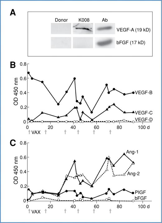 Figure 1. Vaccinated melanoma patient K008 developed antibodies to multiple angiogenic cytokines. A, sera from K008, but not healthy donors, (n = 3) recognize VEGF-A, but not bFGF by immunoblotting (sera at 1:100). Control anticytokine antibodies are shown for comparison. B, longitudinal analysis of antibodies to VEGF family members in K008. Antigen-specific IgG levels were determined with an ELISA (sera at 1:100). Arrows denote vaccinations. Day 0 is prevaccination. C, vaccination-stimulated potent humoral reactions to angiopoietin (Ang)-1 and Ang-2 in K008. A subcutaneous nodule developed hemorrhagic necrosis after the fifth immunization. Day 0 is prevaccination.