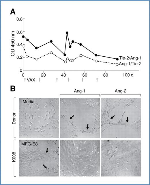 Figure 2. Vaccine-induced antibodies to Ang-1 and Ang-2 manifest blocking activity. A, postvaccination K008 sera inhibit the binding of Tie-2 and Ang-1 as measured with an ELISA (sera at 1:10). Day 0 is prevaccination. Full time-course studies were performed twice with similar results, whereas high- and low-blocking samples were analyzed 2 additional times, with equivalent findings. B, sera from K008, but not healthy donors, inhibit Ang-1 and Ang-2–induced tube formation with HUVECs. K008 sera failed to block MFG-E8–stimulated tube formation. This experiment was performed 2 times with similar results. Prevaccination sera from K008 were not available for this assay. Representative high-power fields are shown. Tube-forming scores (averages of 6 replicates) were: donor (media) 0, (angiopoetin-1) 3.5, (Ang-2) 3; K008 (MFG-E8) 2.67, (Ang-1) 0.83, and (Ang-2) 0.33.