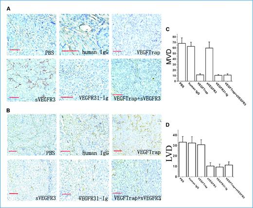 Figure 6. VEGFR31-Ig inhibits tumor angiogenesis and lymphangiogenesis in the HCCLM3 hepatocellular carcinoma tumor model. At 6 wk following tumor inoculation, HCCLM3 primary tumors from mice treated with PBS, control human IgG, VEGFTrap, sVEGFR3, VEGFR31-Ig, or VEGFTrap plus sVEGFR3 were harvested and analyzed for blood vessels using a rat anti-mouse CD31 antibody and for lymphatic vessels using a rat anti-mouse LYVE-1 antibody by immunohistochemistry. A, representative sections for immunohistochemical staining using CD31 antibody (magnification, ×200). Scale bars, 50 μm. B, representative sections for immunohistochemical staining using LYVE-1 antibody (magnification, ×200). Scale bars, 50 μm. C and D, quantification of CD31-positive vessels (C) and LYVE-1–positive vessels (D) in HCCLM3 primary tumors from mice treated with PBS, control human IgG, VEGFTrap, sVEGFR3, VEGFR31-Ig, or VEGFTrap plus sVEGFR3. Columns, mean; bars, SD.