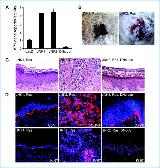 Figure 2. Coactivation of JNK2 and Ras transforms human epidermal cells into malignancy. A, AP-1 gene reporter assay. Expressions of the recombinant JNK proteins were confirmed by immunoblotting (Supplementary Fig. S2A). B to D, human skin tissues regenerated with primary human keratinocytes transduced to express genes denoted on top of each image: B, clinical appearance; C, histologic analysis by H&E staining (E, epidermis; D, dermis; V, blood vessel); D, immunofluorescent staining for collagen VII (ColVII) and Ki-67 (orange); nuclei are in blue. Magnification, ×100 (C and D). No metastasis was observed during the time frame of these experiments.